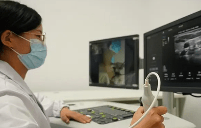 ultrasonic scanning